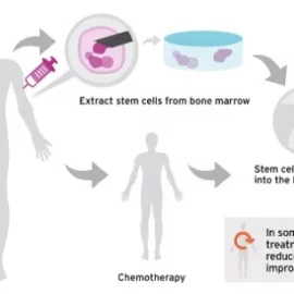 What are the Top 7 Countries in the Americas for Stem cell and Exosome therapy? What are the Top 7 Countries in the Americas for Stem cell and Exosome therapy?