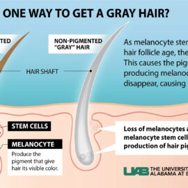 Why does hair turn gray? Why does hair turn gray?